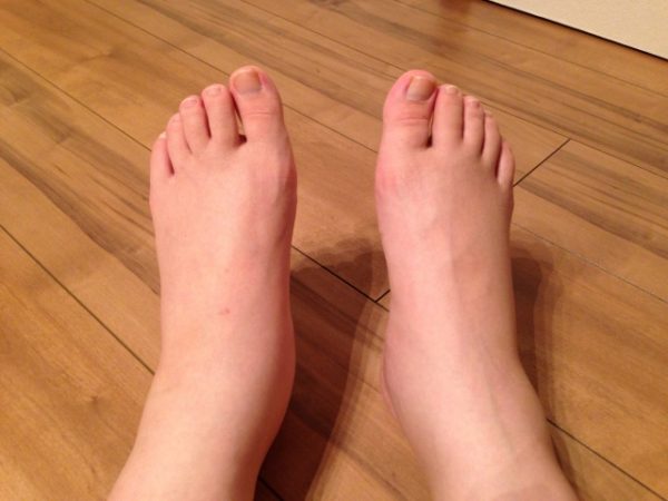 どのような症状がありますか?