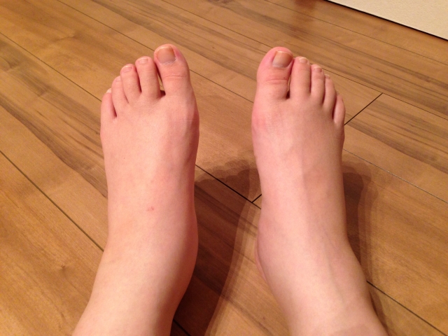 顔が腫れるのはなぜですか?